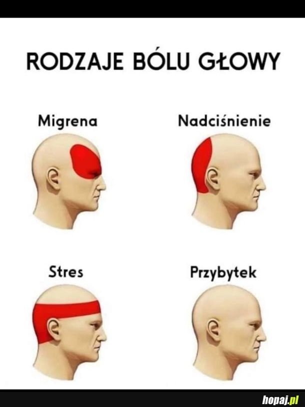 Rodzaje bólu głowy