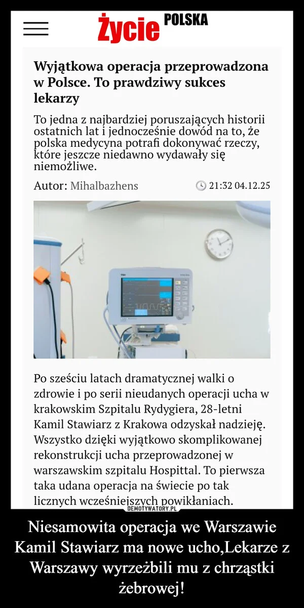 
    Niesamowita operacja we Warszawie Kamil Stawiarz ma nowe ucho,Lekarze z Warszawy wyrzeżbili mu z chrząstki żebrowej!