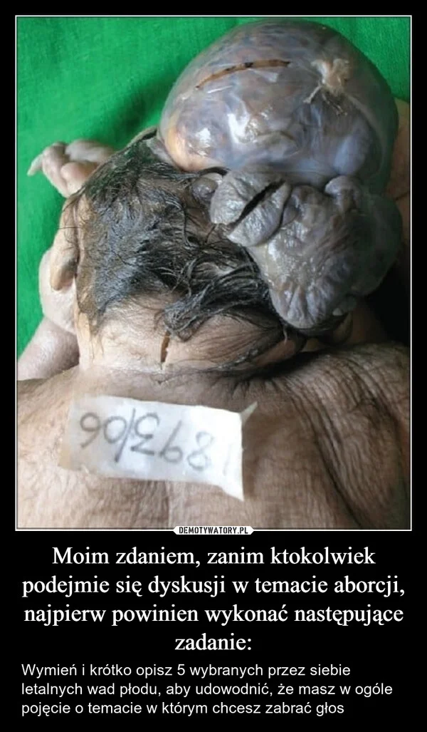 
    Moim zdaniem, zanim ktokolwiek podejmie się dyskusji w temacie aborcji, najpierw powinien wykonać następujące zadanie: