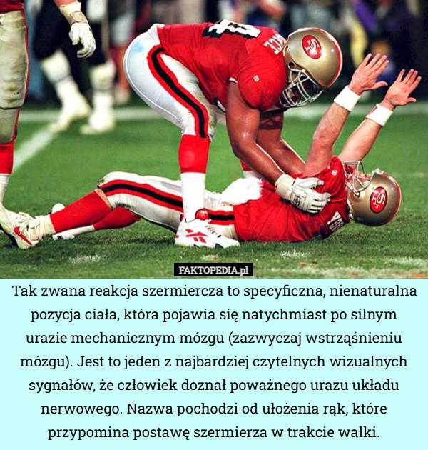 
    Tak zwana reakcja szermiercza to specyficzna, nienaturalna pozycja ciała,