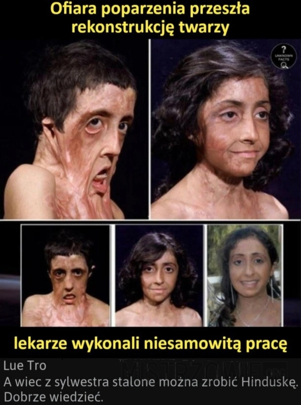 Rekonstrukcja twarzy