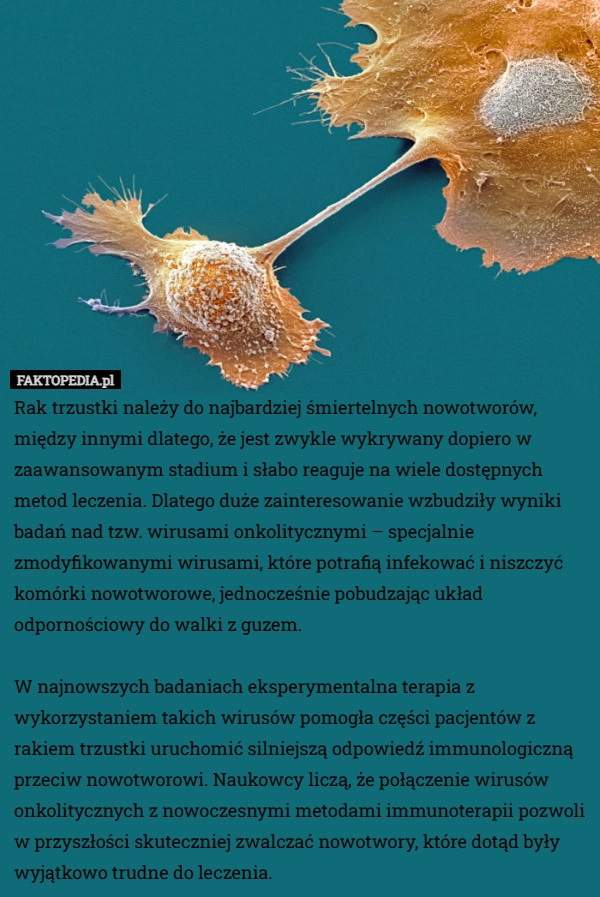 Rak trzustki należy do najbardziej śmiertelnych nowotworów, między innymi