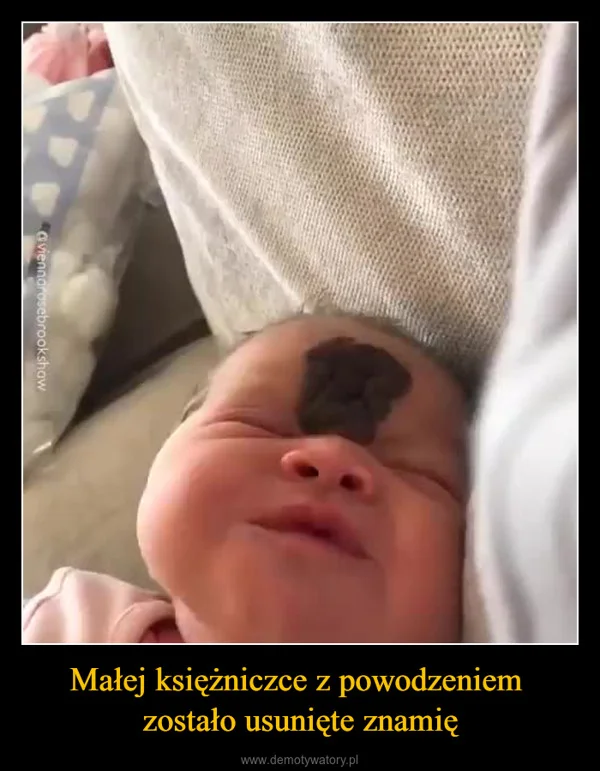 
    Małej księżniczce z powodzeniem zostało usunięte znamię