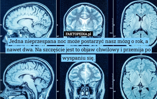 Jedna nieprzespana noc może postarzyć nasz mózg o rok, a nawet dwa. Na szczęście