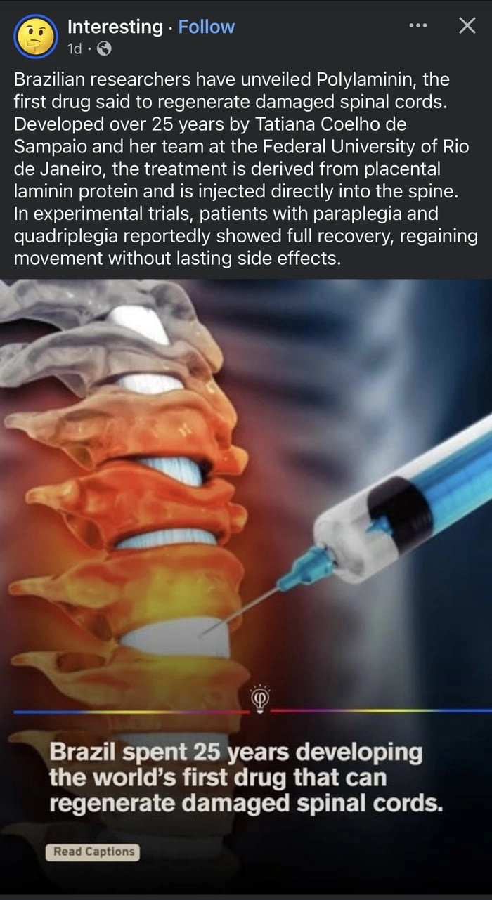 
    A hope for walking again