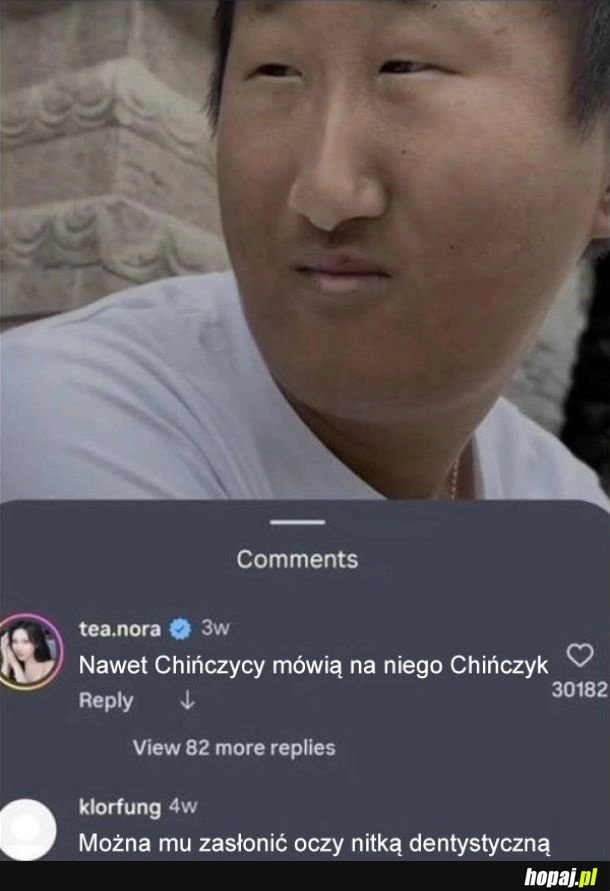 Xd