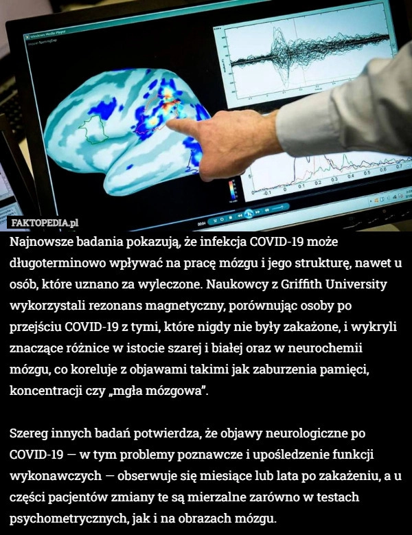 Najnowsze badania pokazują, że infekcja COVID-19 może długoterminowo wpływać
