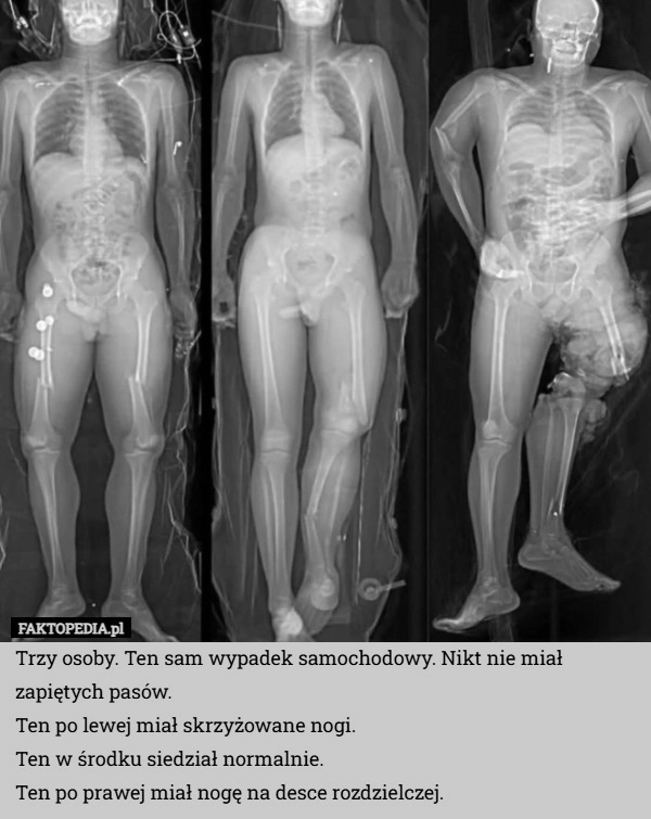 
    Trzy osoby. Ten sam wypadek samochodowy. Nikt nie miał zapiętych pasów.
